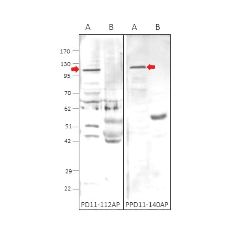 Anti-PDE11A Antibody from FabGennix (PD11A-101AP) - Antibodies.com