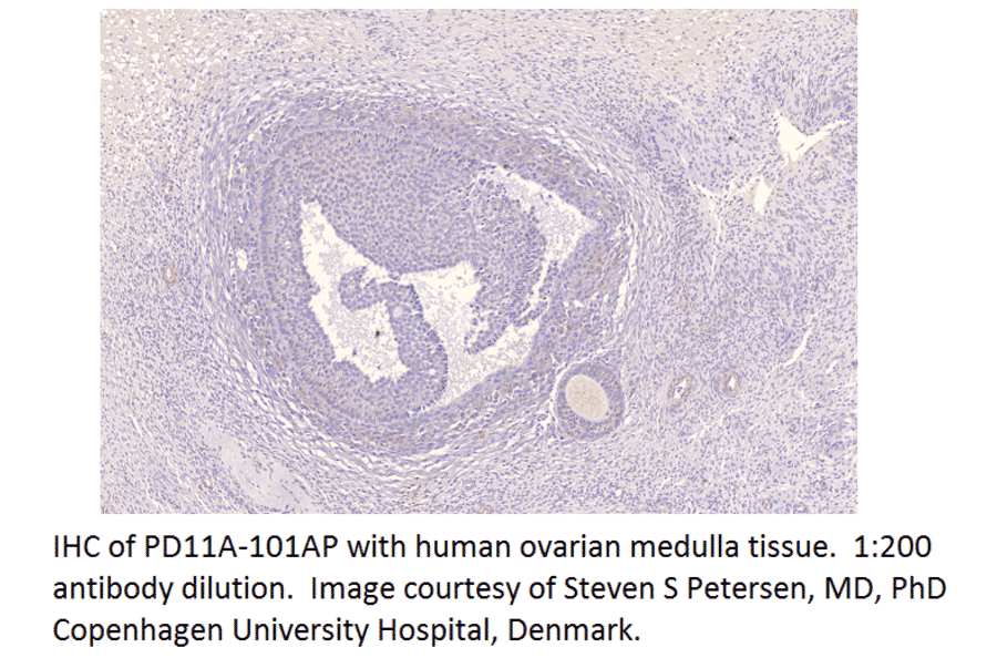 Anti-PDE11A Antibody from FabGennix (PD11A-101AP) - Antibodies.com