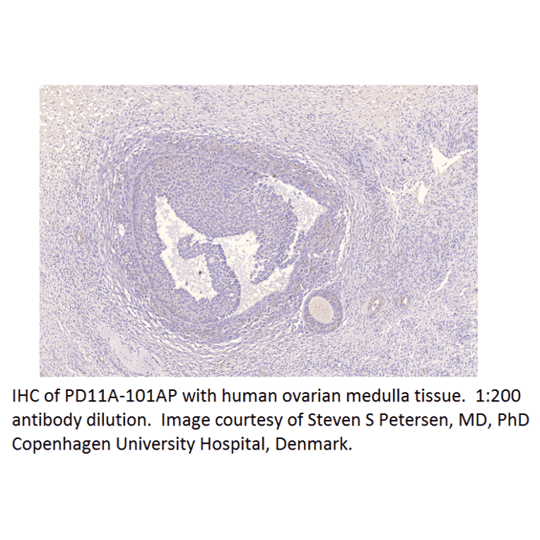 Anti-PDE11A Antibody from FabGennix (PD11A-101AP) - Antibodies.com