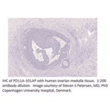 Anti-PDE11A Antibody from FabGennix (PD11A-101AP) - Antibodies.com