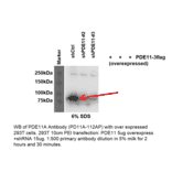 Anti-PDE11A Antibody from FabGennix (PD11A-112AP) - Antibodies.com