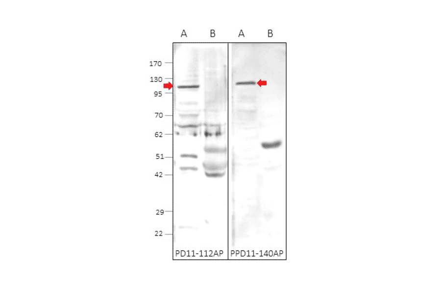 Anti-PDE11A Antibody from FabGennix (PD11A-112AP) - Antibodies.com