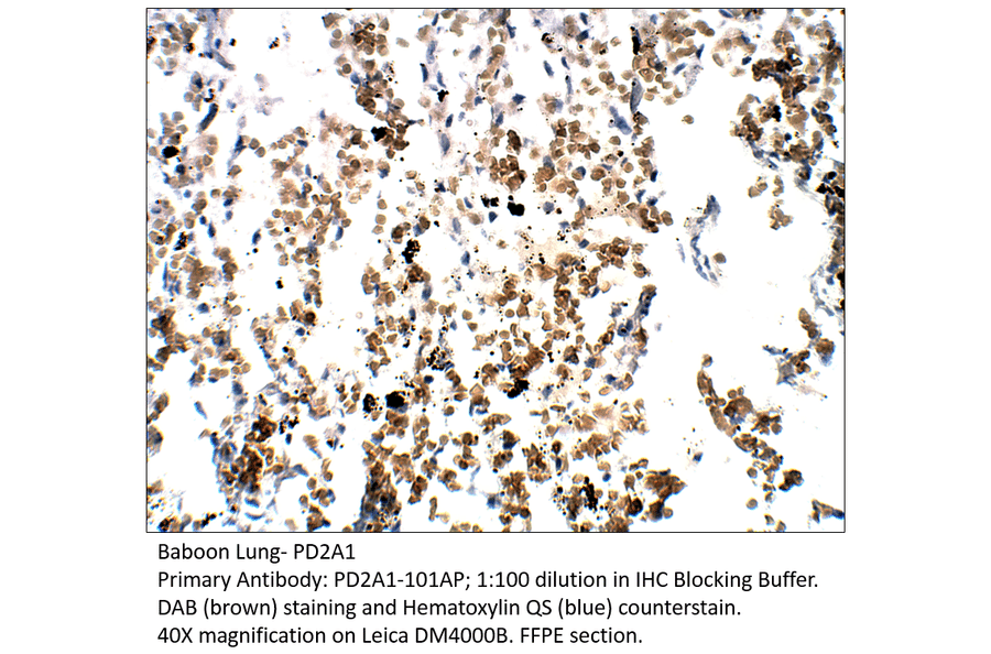 Anti-PDE2A1 Antibody from FabGennix (PD2A1-101AP) - Antibodies.com