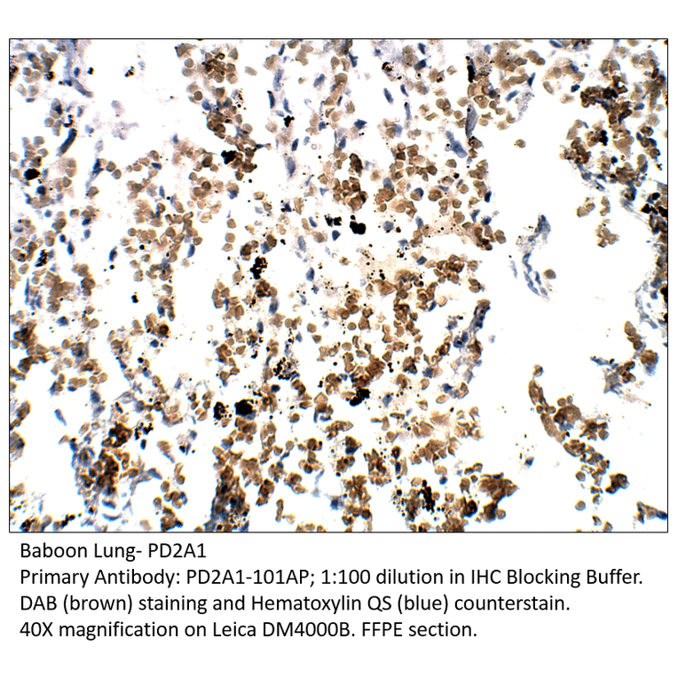 Anti-PDE2A1 Antibody from FabGennix (PD2A1-101AP) - Antibodies.com