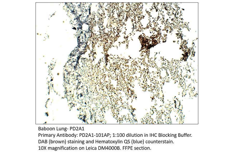 Anti-PDE2A1 Antibody from FabGennix (PD2A1-101AP) - Antibodies.com