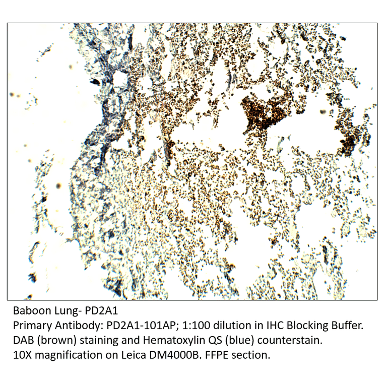 Anti-PDE2A1 Antibody from FabGennix (PD2A1-101AP) - Antibodies.com