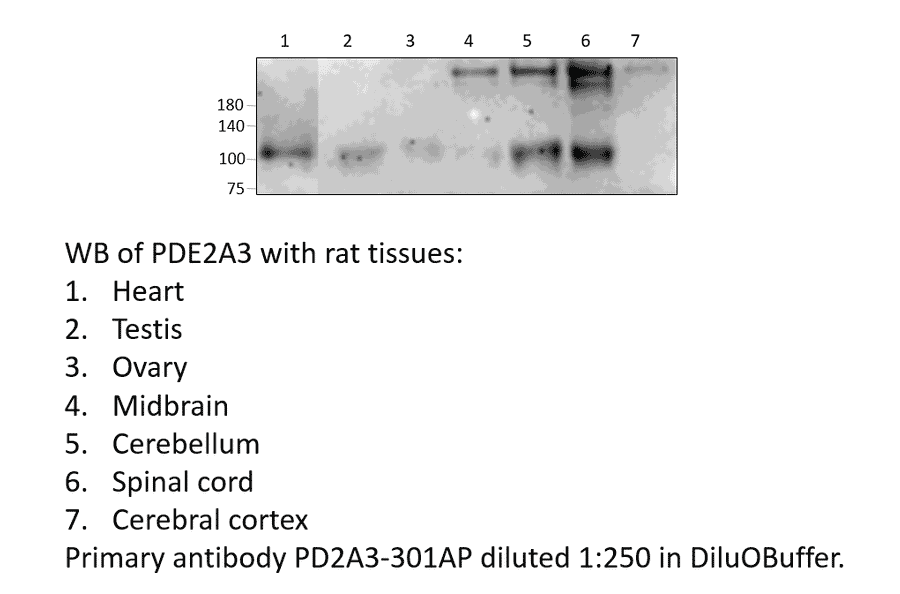 Anti-PDE2A3 Antibody from FabGennix (PD2A3-301AP) - Antibodies.com