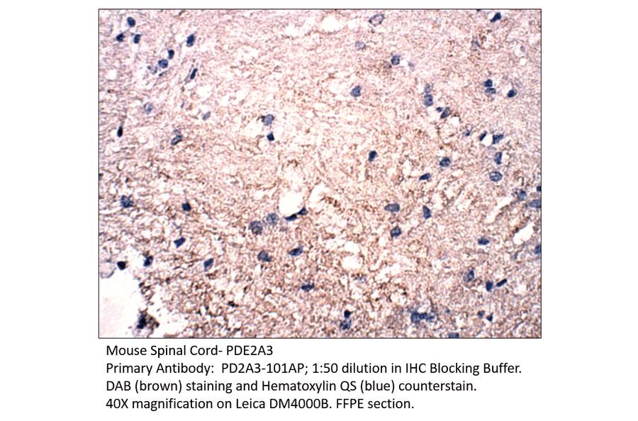 Anti-PDE2A3 Antibody from FabGennix (PD2A3-301AP) - Antibodies.com