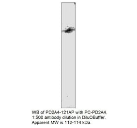 Anti-PDE2A4 Antibody from FabGennix (PD2A4-121AP) - Antibodies.com