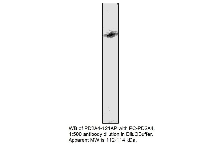 Anti-PDE2A4 Antibody from FabGennix (PD2A4-121AP) - Antibodies.com