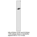 Anti-PDE2A4 Antibody from FabGennix (PD2A4-121AP) - Antibodies.com