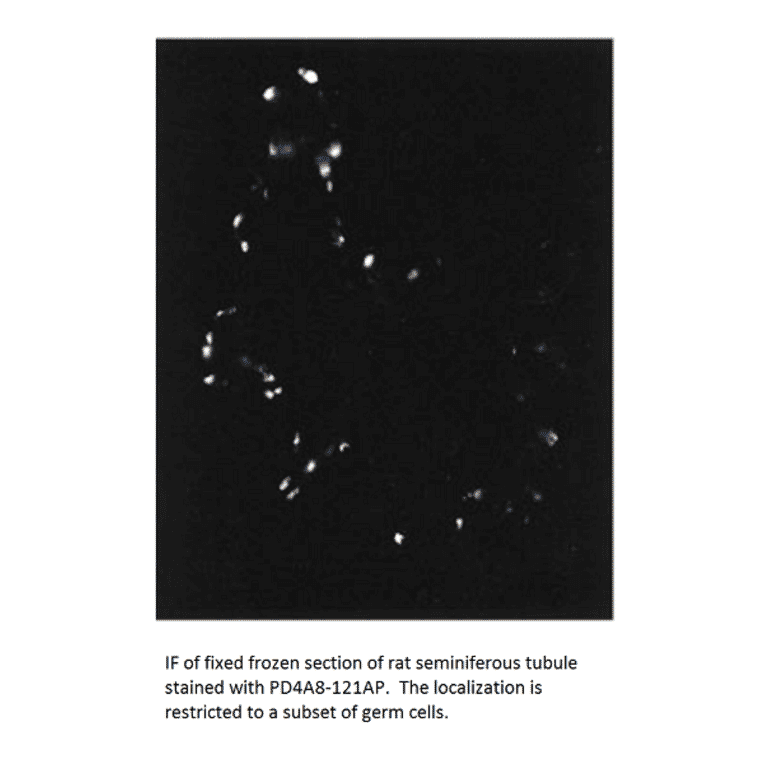 Anti-PDE4A8 Antibody from FabGennix (PD4A8-121AP) - Antibodies.com