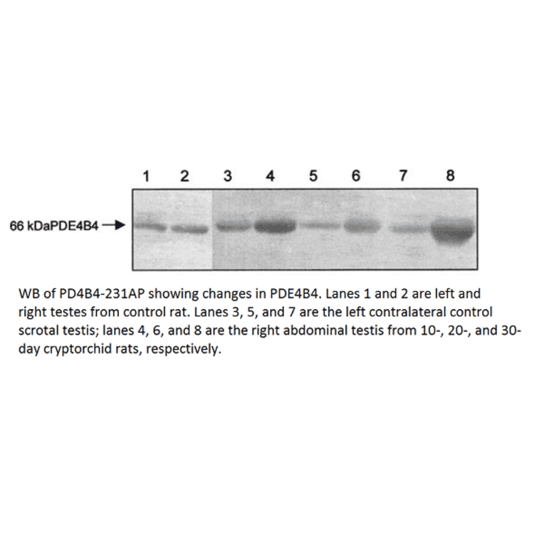 Anti-PDE4B4 Antibody from FabGennix (PD4B4-231AP) - Antibodies.com