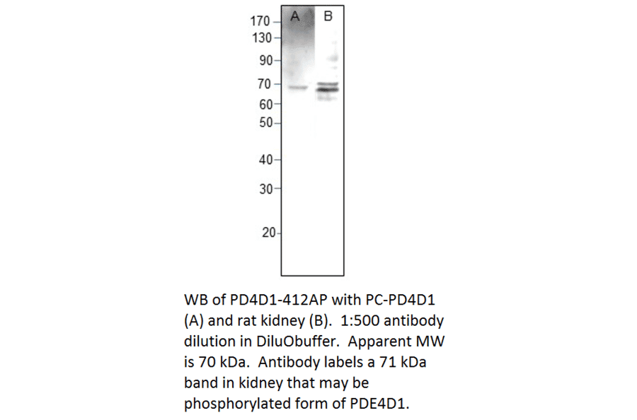 Anti-PDE4D1 Antibody from FabGennix (PD4D1-412AP) - Antibodies.com