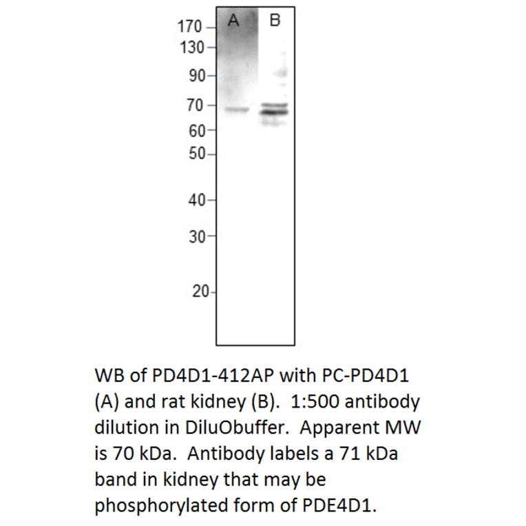 Anti-PDE4D1 Antibody from FabGennix (PD4D1-412AP) - Antibodies.com