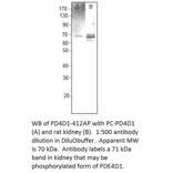 Anti-PDE4D1 Antibody from FabGennix (PD4D1-412AP) - Antibodies.com