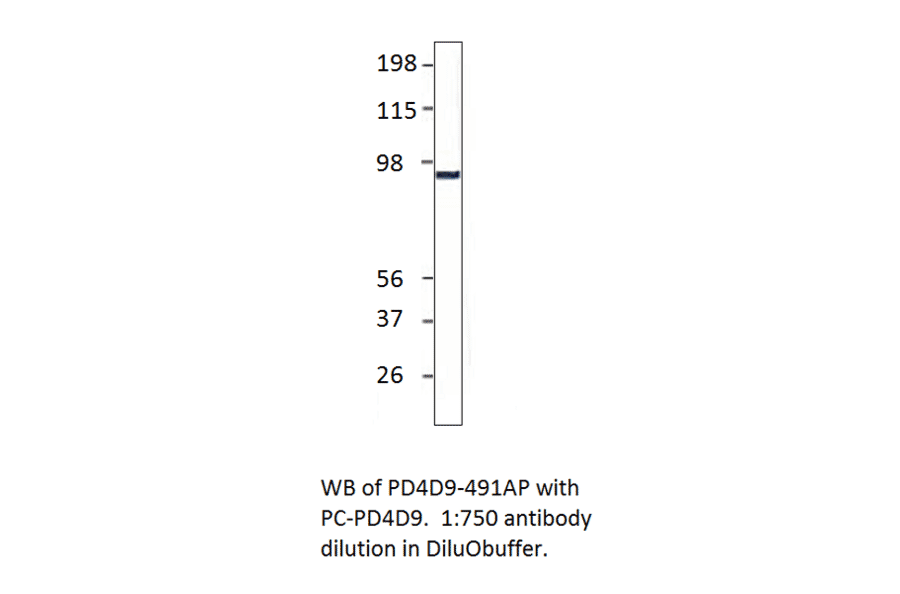Anti-PDE4D9 Antibody from FabGennix (PD4D9-491AP) - Antibodies.com