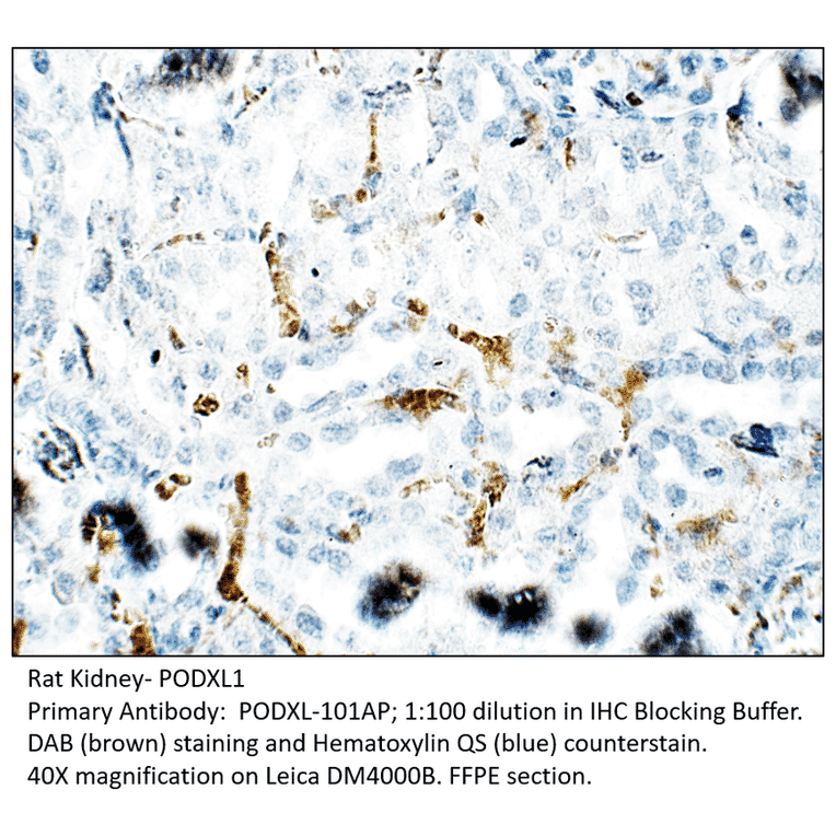 Anti-PODXL1 Antibody from FabGennix (PODXL-101AP) - Antibodies.com