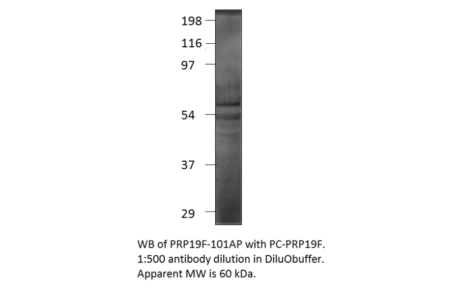 Anti-PRP19 Antibody from FabGennix (PRP19F-101AP) - Antibodies.com