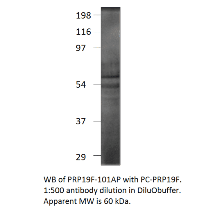 Anti-PRP19 Antibody from FabGennix (PRP19F-101AP) - Antibodies.com