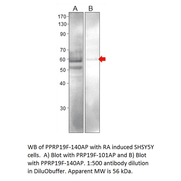 Anti-PRP19 Antibody from FabGennix (PRP19F-101AP) - Antibodies.com