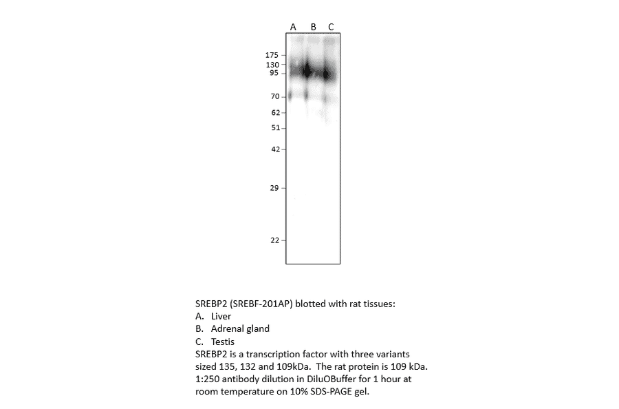 Anti-SREBP2 Antibody from FabGennix (SREBF-201AP) - Antibodies.com