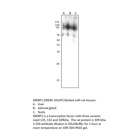 Anti-SREBP2 Antibody from FabGennix (SREBF-201AP) - Antibodies.com