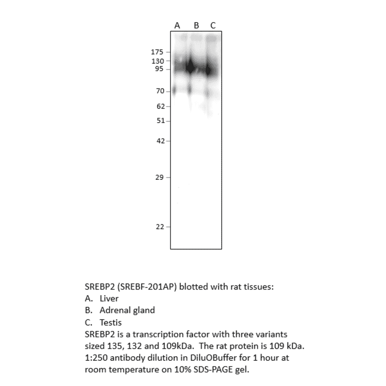 Anti-SREBP2 Antibody from FabGennix (SREBF-201AP) - Antibodies.com