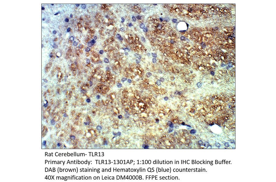Anti-TLR13 Antibody from FabGennix (TLR13-1301AP) - Antibodies.com