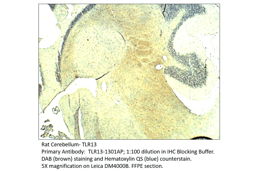 Anti-TLR13 Antibody from FabGennix (TLR13-1301AP) - Antibodies.com