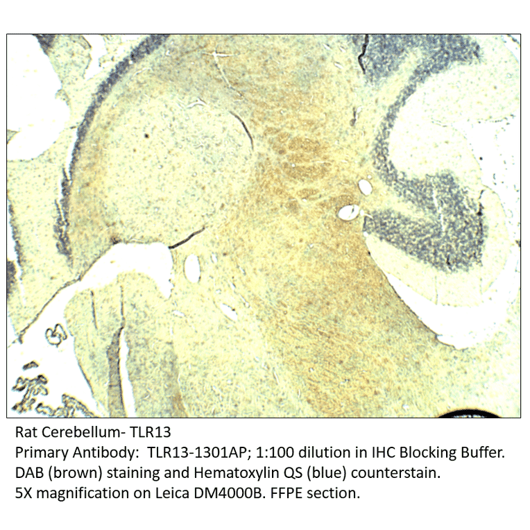 Anti-TLR13 Antibody from FabGennix (TLR13-1301AP) - Antibodies.com