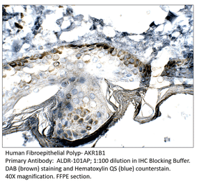 Anti-AKR1B1 Antibody from FabGennix (ALDR-101AP) - Antibodies.com