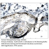 Anti-AKR1B1 Antibody from FabGennix (ALDR-101AP) - Antibodies.com