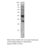 Anti-ASF1A Antibody from FabGennix (ASF1A-101AP) - Antibodies.com
