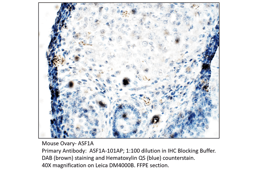 Anti-ASF1A Antibody from FabGennix (ASF1A-101AP) - Antibodies.com