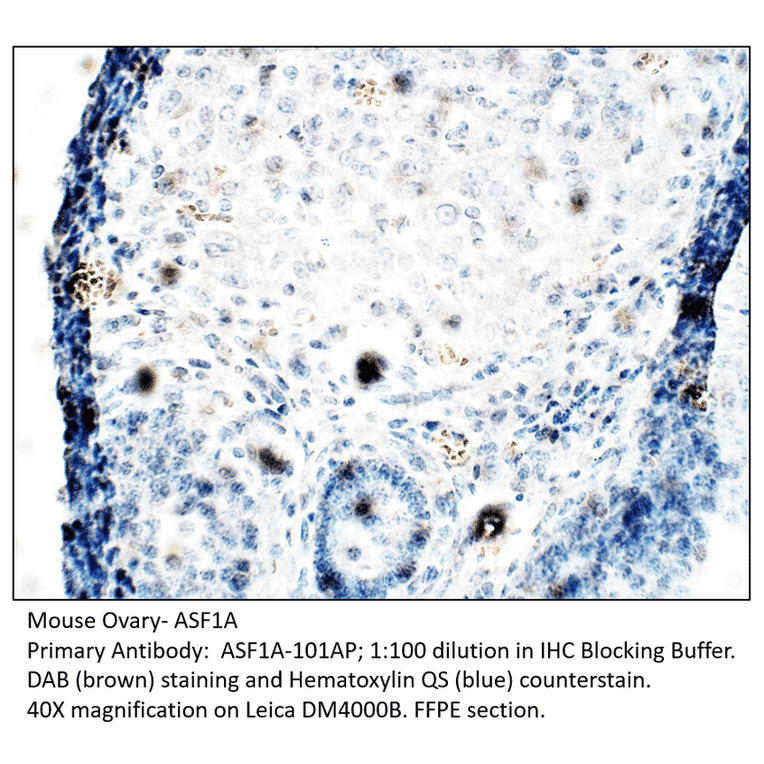 Anti-ASF1A Antibody from FabGennix (ASF1A-101AP) - Antibodies.com