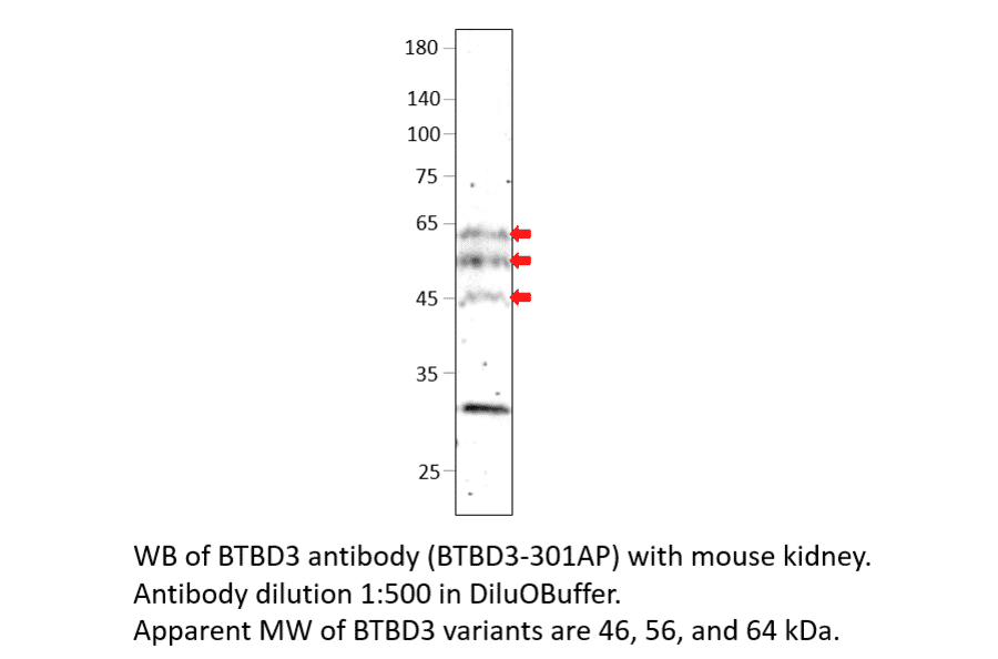 Anti-BTBD3 Antibody from FabGennix (BTBD3-301AP) - Antibodies.com
