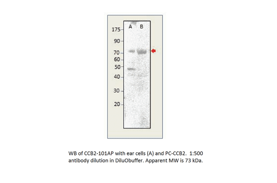 Anti-CACNB2 Antibody from FabGennix (CCB2-101AP) - Antibodies.com