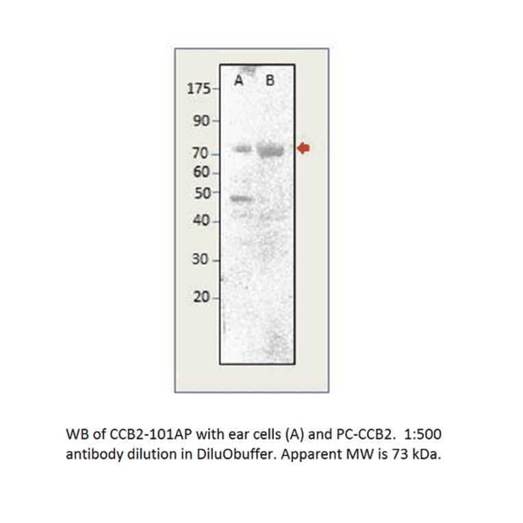 Anti-CACNB2 Antibody from FabGennix (CCB2-101AP) - Antibodies.com