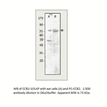 Anti-CACNB2 Antibody from FabGennix (CCB2-101AP) - Antibodies.com