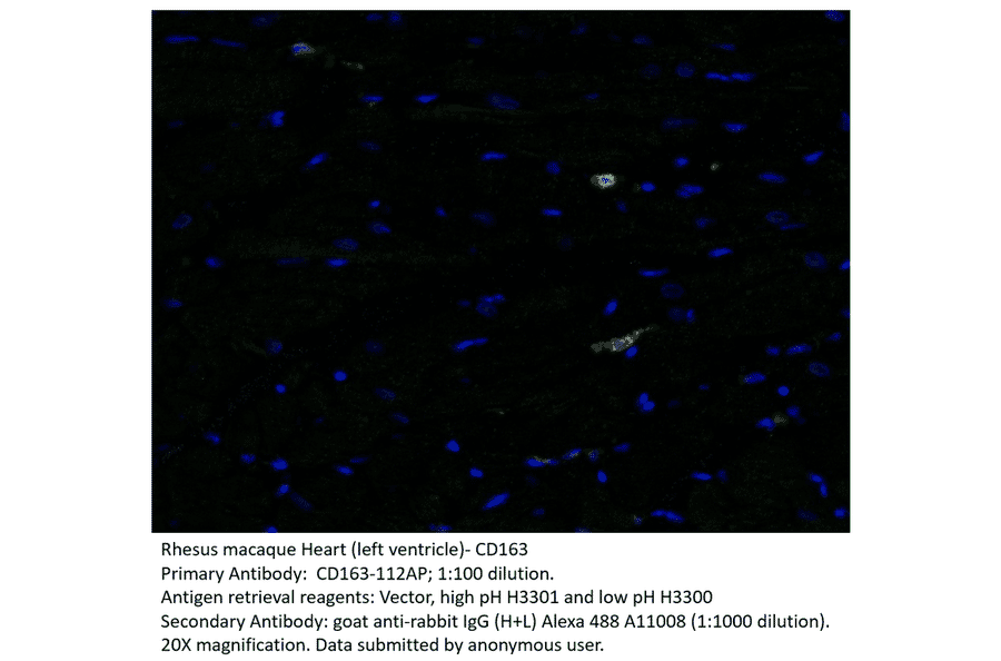 Anti-CD163 Antibody from FabGennix (CD163-112AP) - Antibodies.com