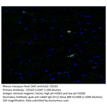 Anti-CD163 Antibody from FabGennix (CD163-112AP) - Antibodies.com