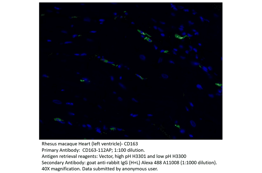 Anti-CD163 Antibody from FabGennix (CD163-112AP) - Antibodies.com
