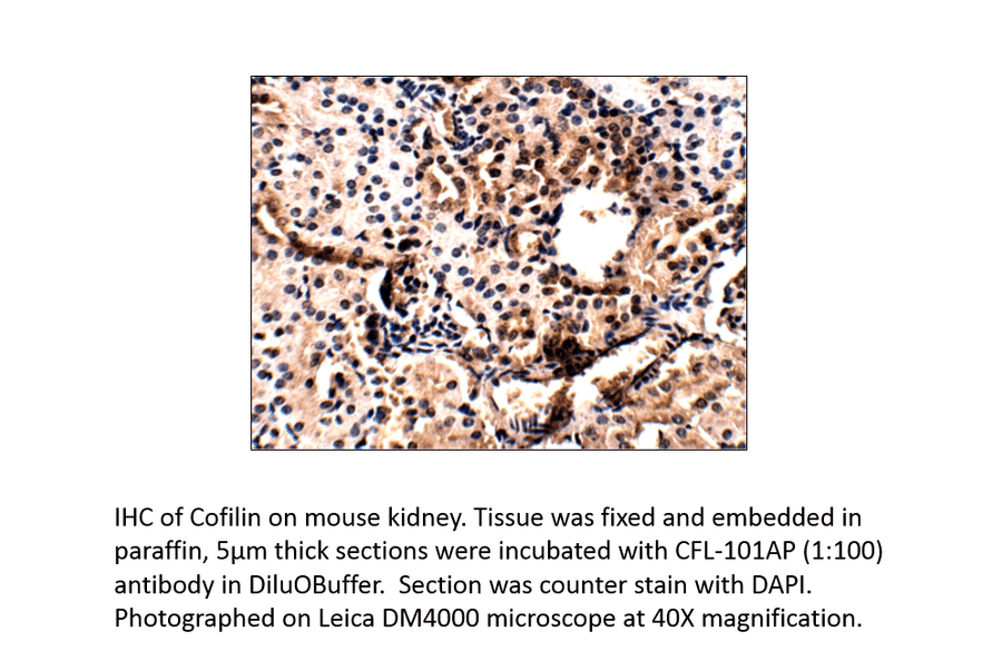 Anti-Cofilin Antibody from FabGennix (CFL-101AP) - Antibodies.com