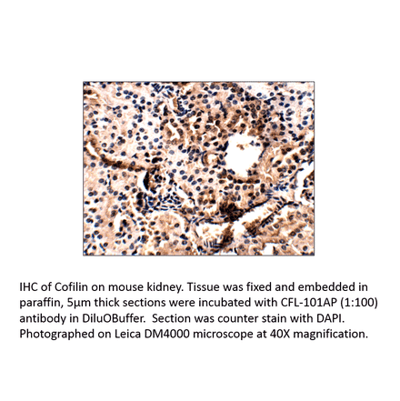 Anti-Cofilin Antibody from FabGennix (CFL-101AP) - Antibodies.com