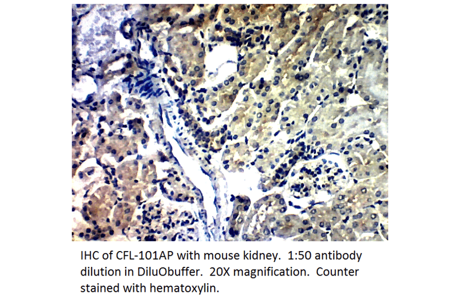 Anti-Cofilin Antibody from FabGennix (CFL-101AP) - Antibodies.com