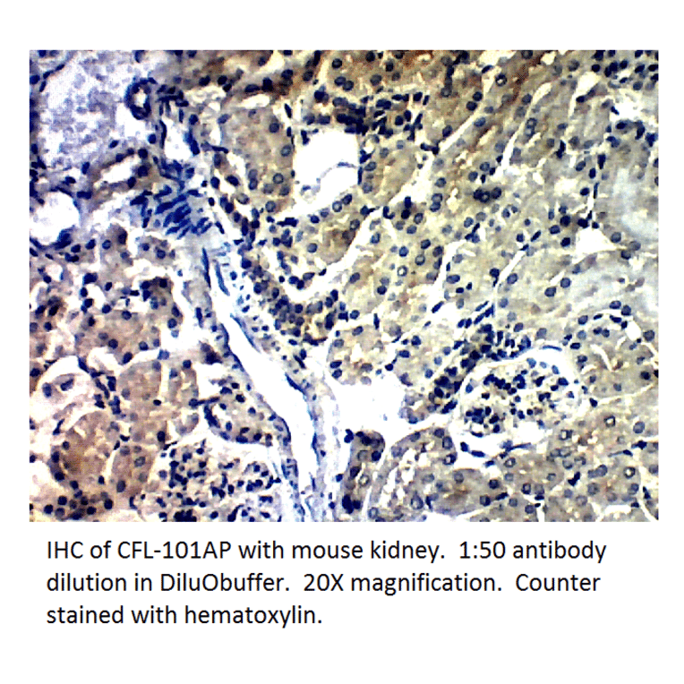 Anti-Cofilin Antibody from FabGennix (CFL-101AP) - Antibodies.com