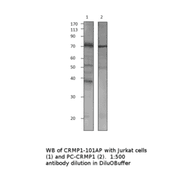 Anti-CRMP1 Antibody from FabGennix (CRMP1-101AP) - Antibodies.com