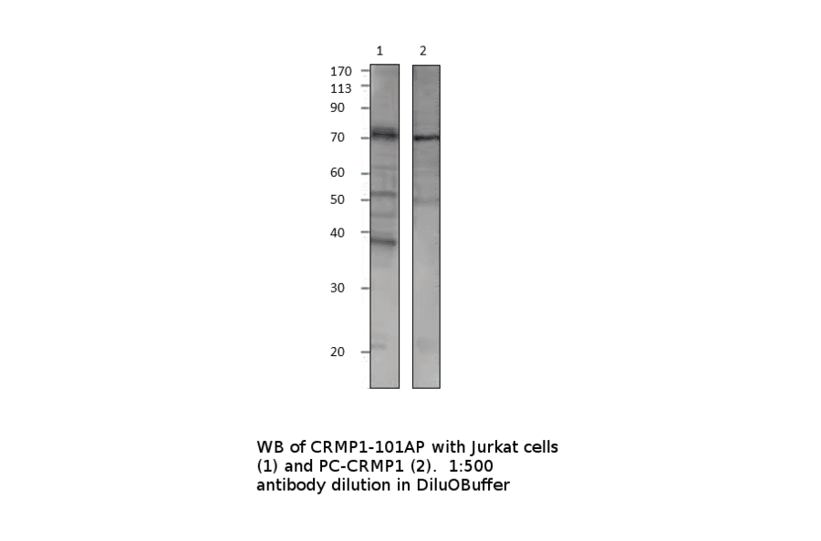 Anti-CRMP1 Antibody from FabGennix (CRMP1-101AP) - Antibodies.com