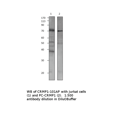 Anti-CRMP1 Antibody from FabGennix (CRMP1-101AP) - Antibodies.com